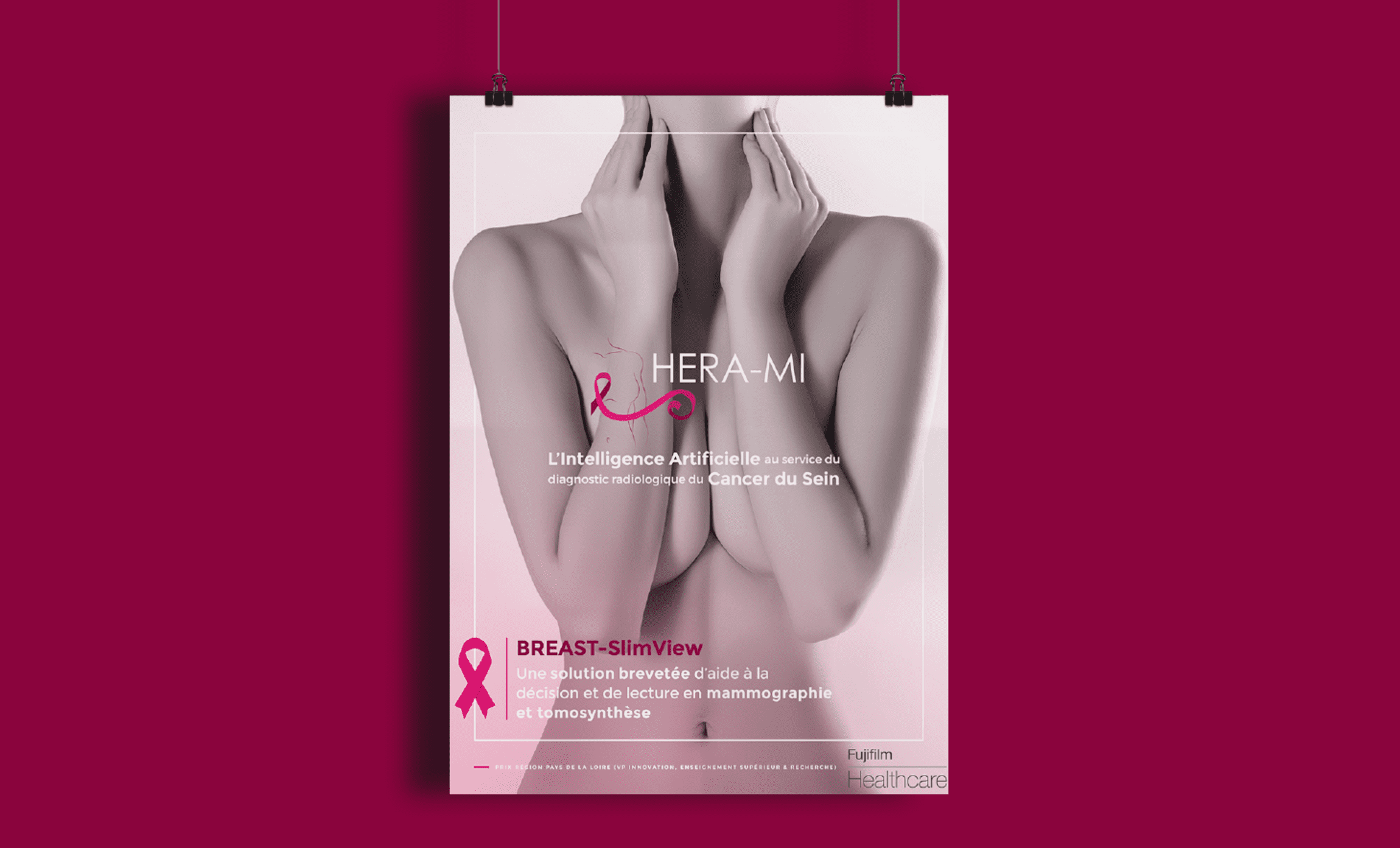 Affiche Hera mi dépistage cancer du sein mammographie Digisanté