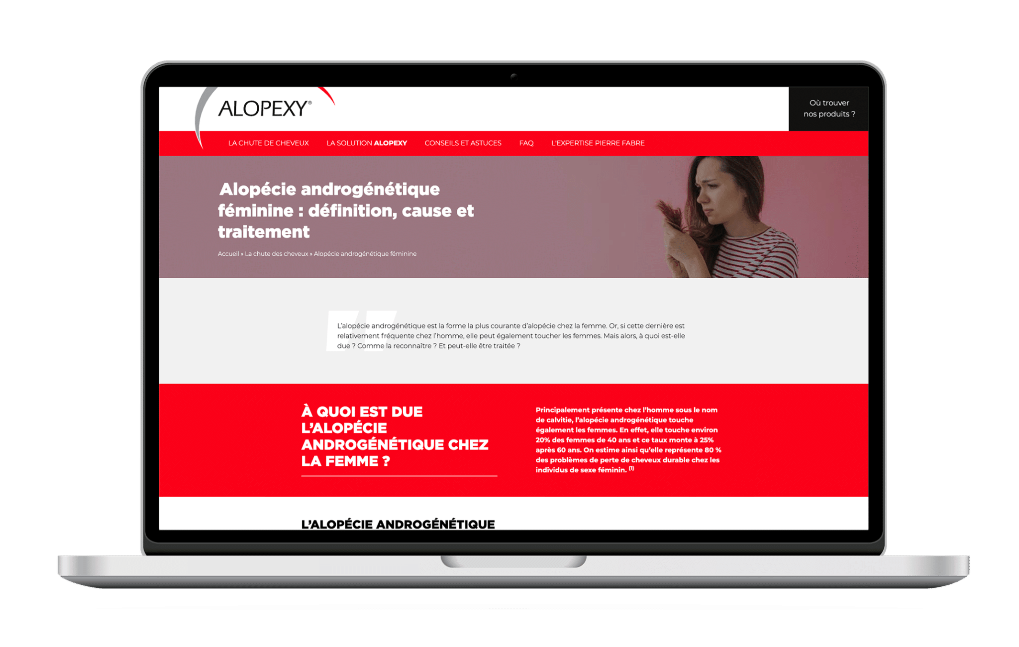 Alopécie_Site Desktop 
