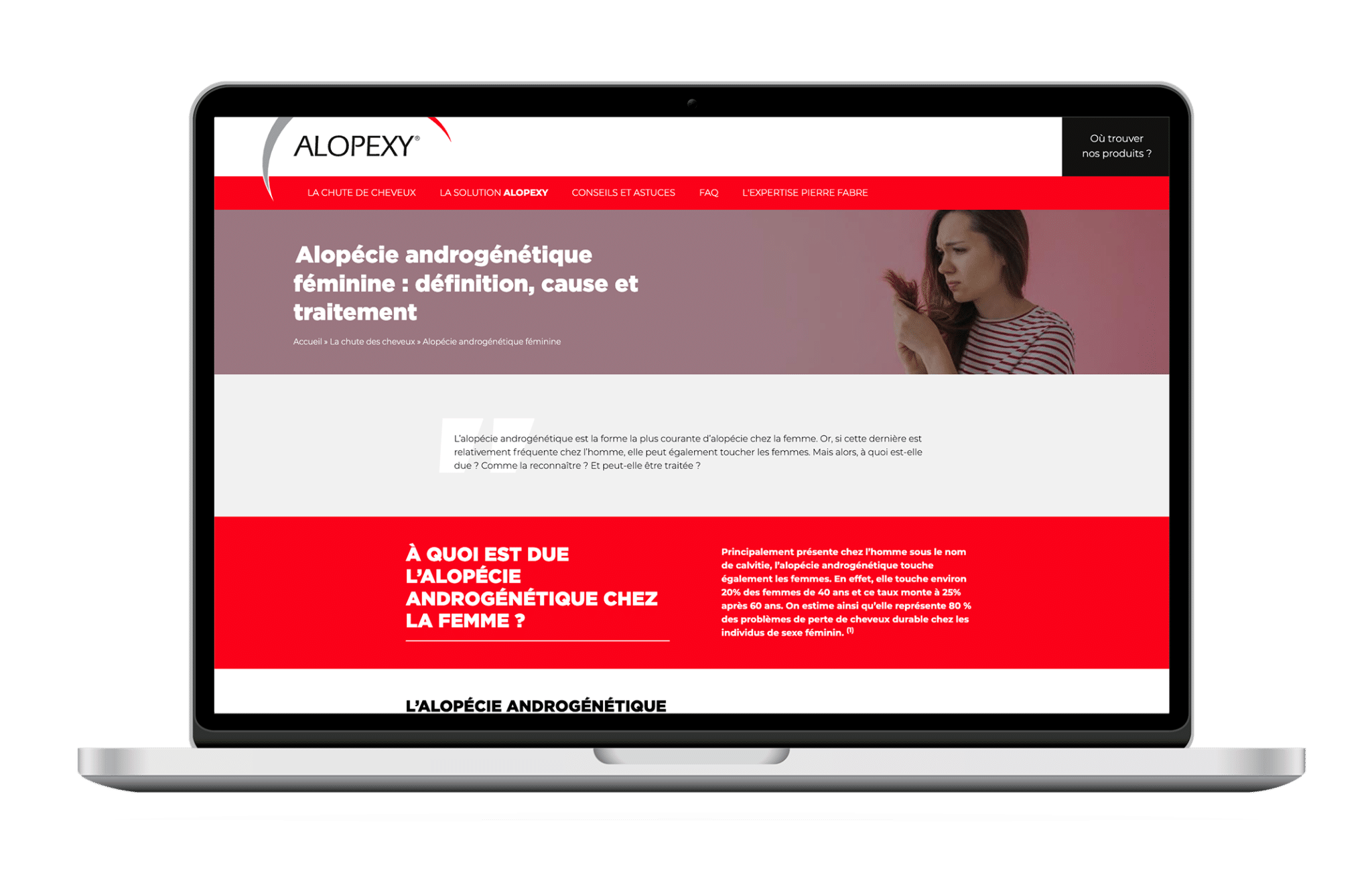 Alopécie_Site Desktop